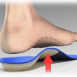 orthotics 2